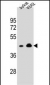 OR10A4 Antibody (C-term)